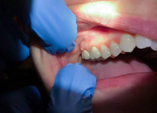 Best Emergency Pediatric Dental Care in Naval Academy, MD