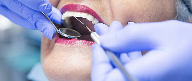 Best Emergency Root Canal Therapy in Naval Academy, MD